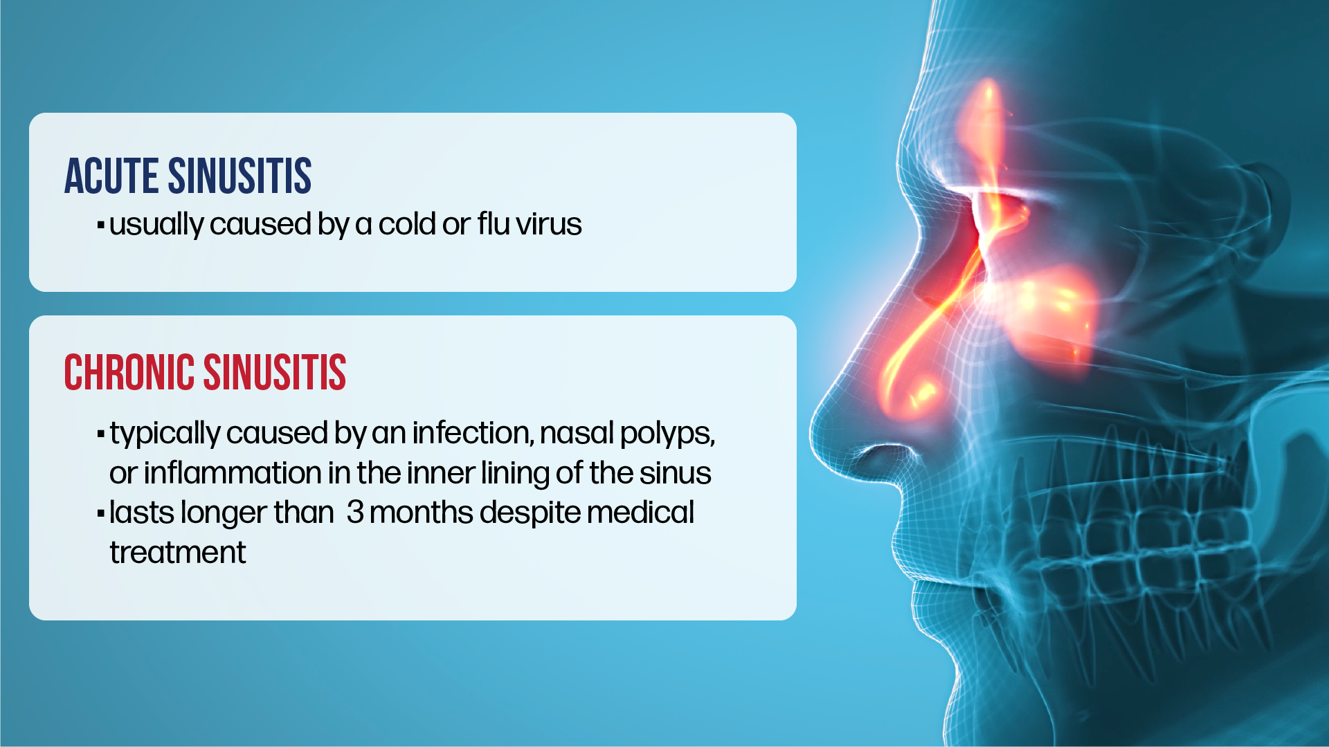 sinusitis-va-disability-rating-vet-claim-solutions