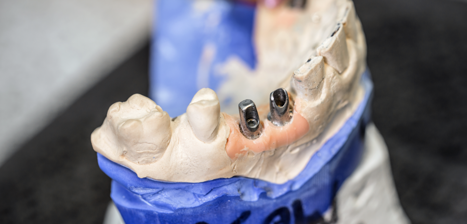 How Do I Qualify for Dental Services with the VA? VET CLAIM SOLUTIONS