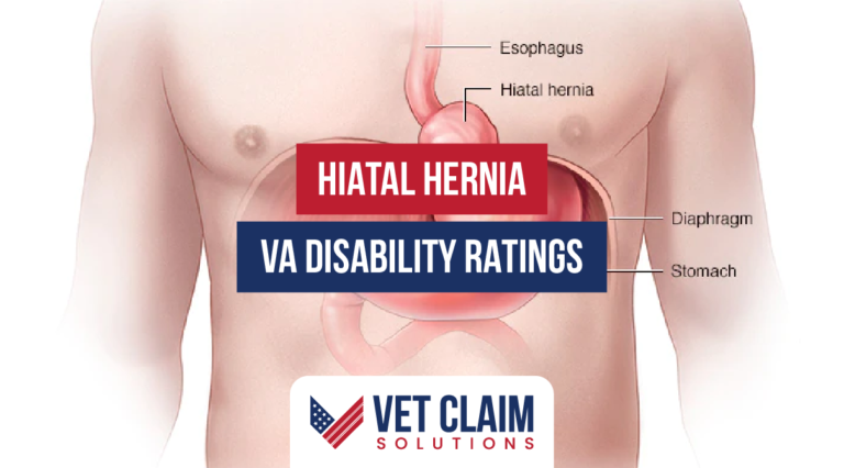 Hiatal Hernia Va Disability Ratings Vet Claim Solutions 1891