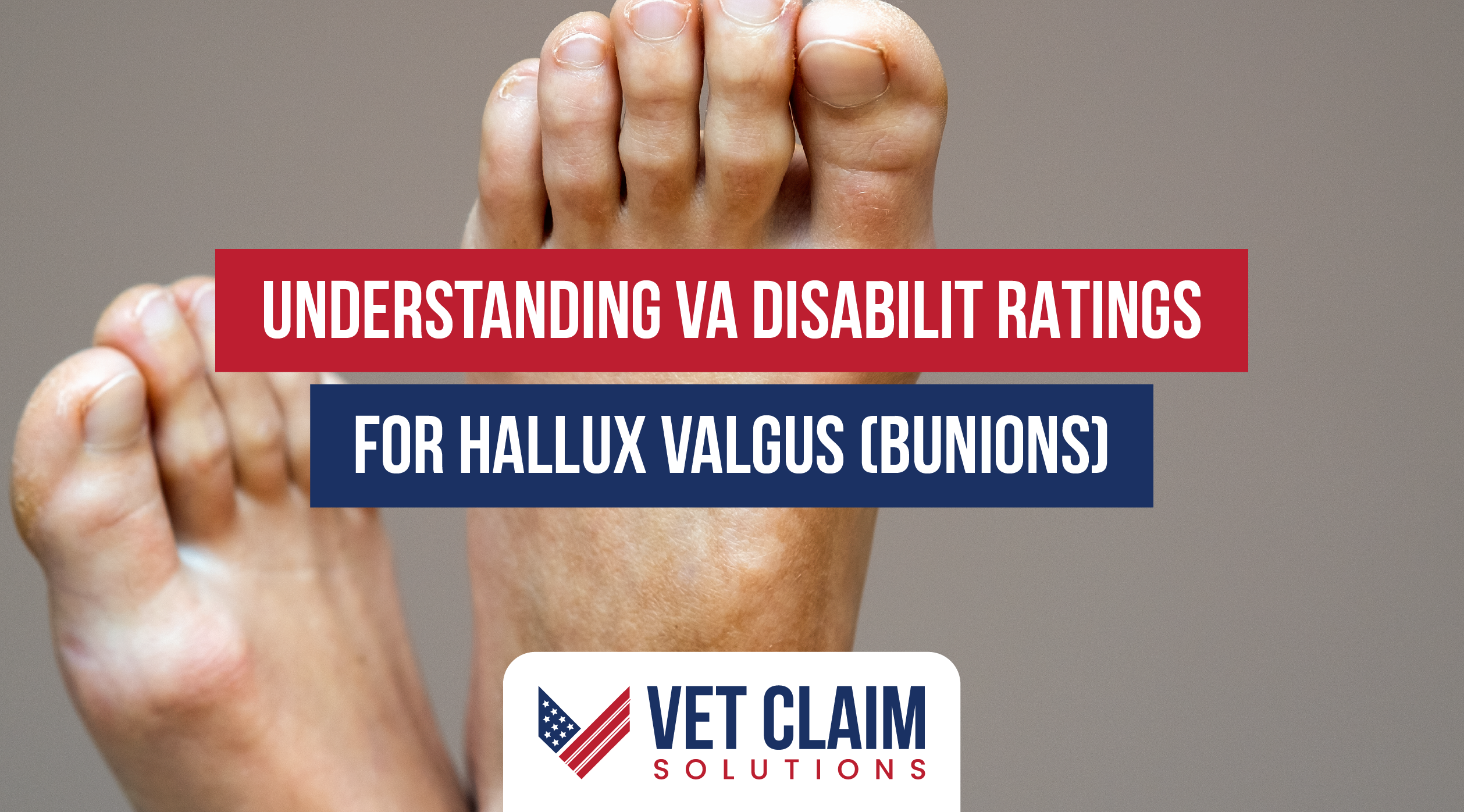 Understanding VA Disability Ratings for Hallux Valgus (Bunions)