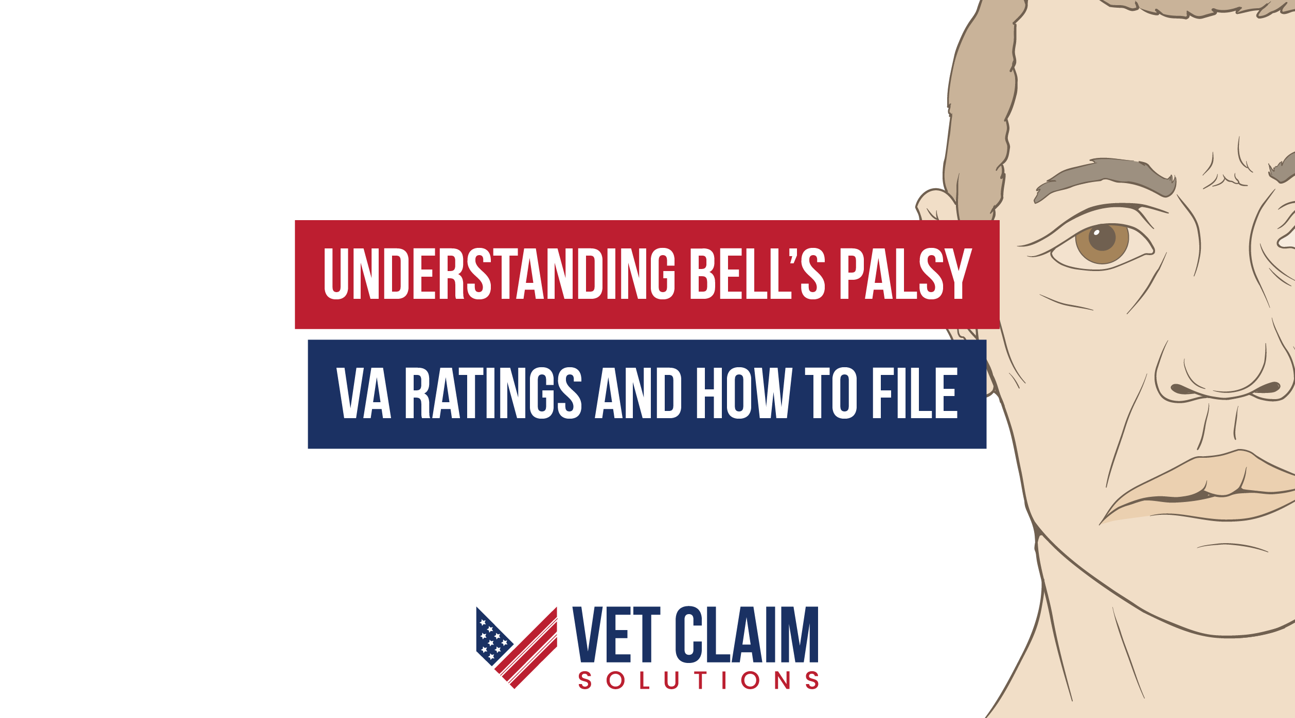 Understanding Bell’s Palsy VA Ratings and How to File