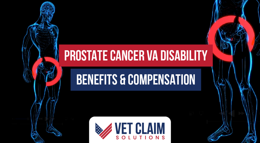 Prostate Cancer as VA Disability Benefits and Compensation