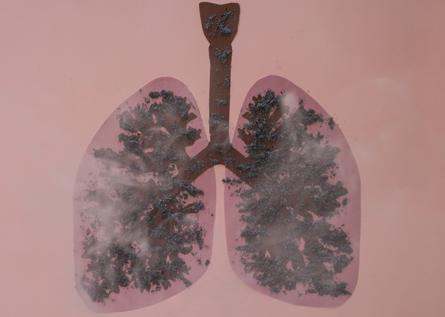 Medical illustration of lungs affected by COPD, showing airflow obstruction and disease impact. 