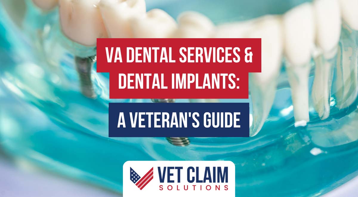VA Dental Services and Dental Implants: A Veteran’s Guide